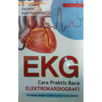Cara Praktis Baca Elektrokardiografi (EKG)