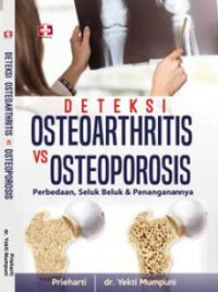 Deteksi Osteoarthritis vs Osteoporosis